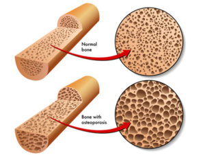 do calcium supplements work