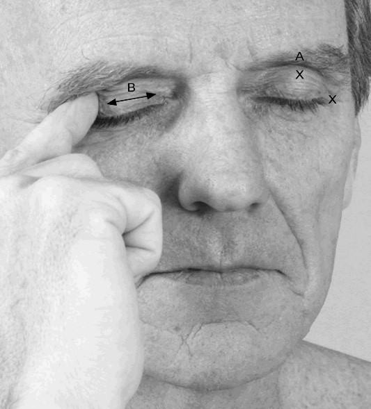 Eye Pain Relief Health Tips From The Professor